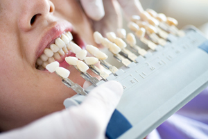 Cosmetic Dentistry at Our International District Dental Clinic