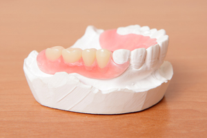 Sixth Avenue Dentistry in the International District Provides Full and Partial Dentures